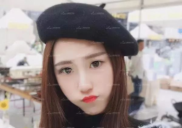 上海埋线双眼皮的适用人群有哪些