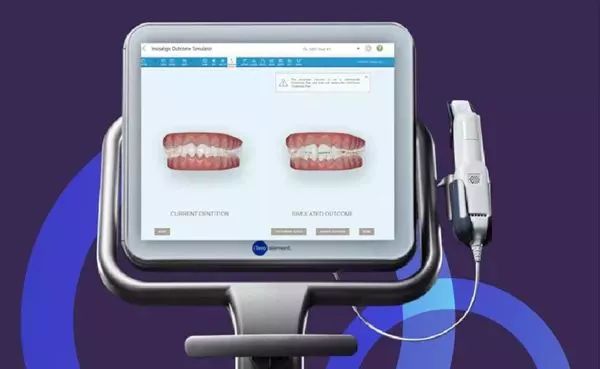 上海瘦脸针效果可以维持多久