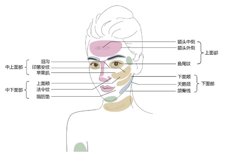 上海美莱切开双眼皮多久能恢复