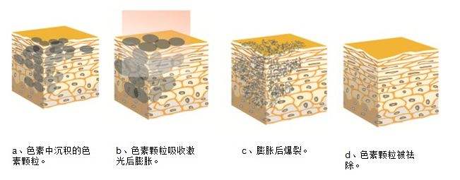 我都已经成年了还能做牙齿矫正吗