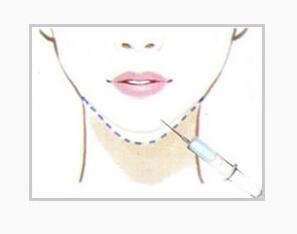 我都已经成年了还能做牙齿矫正吗