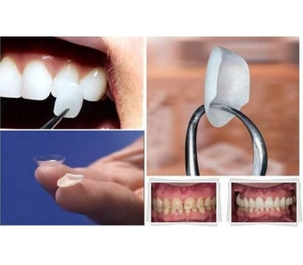 上海激光去黑眼圈需要几次