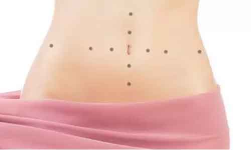 上海美莱激光祛黄褐斑要几次