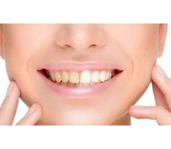 上海美莱瘦脸针多长时间见效