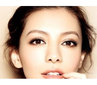 上海美莱割双眼皮多久才能恢复