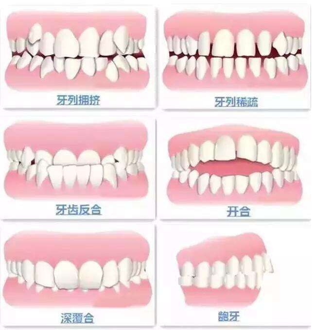 上海祛斑医院皮秒祛斑的效果好不好