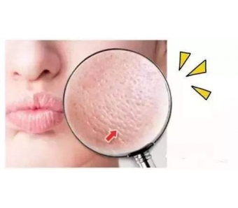 上海隆胸整形美莱做脂肪丰胸怎么样