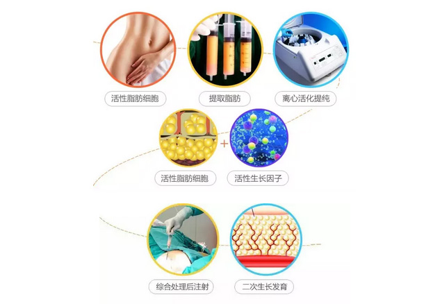 上海美莱彩光嫩肤能去除晒斑吗