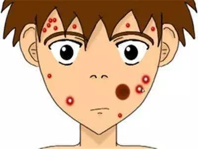 上海注射水光针后需要注意的事项有哪些