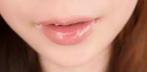 微整形,瘦脸针多少钱