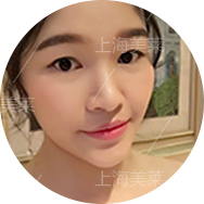 微整形,瘦脸针多少钱