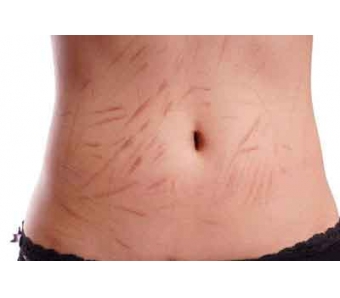 双眼皮手术多少钱在上海