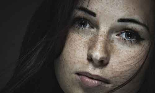 上海皮秒祛斑哪家医院效果好