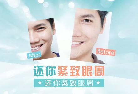 如何分辨自己脸上的斑是什么类型的斑呢