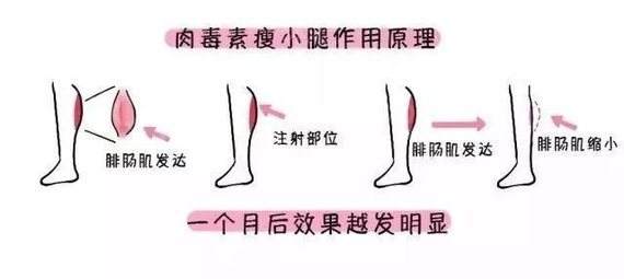 如何分辨自己脸上的斑是什么类型的斑呢