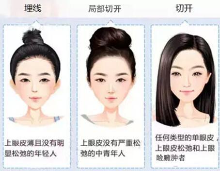 上海做激光除皱面部效果好吗