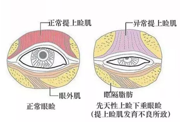 上海做激光除皱面部效果好吗