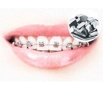 上海做激光脱毛安全吗?痛不痛?