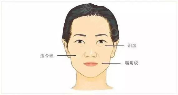 上海做了腰腹吸脂,小肚子会反弹吗