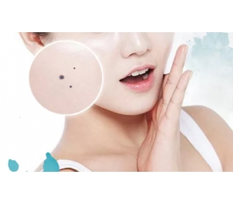 上海注射玻尿酸隆鼻效果怎么样,能维持多长时间?