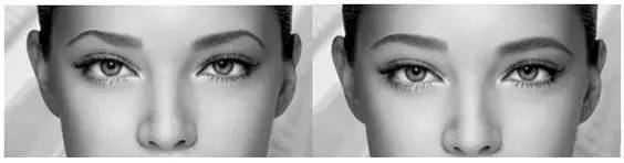 上海注射了瘦脸针能保持多长时间