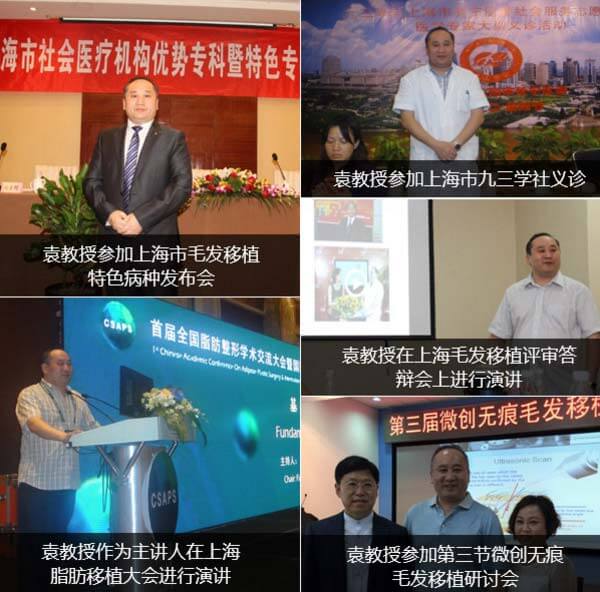 上海做头发种植需要几次才能达到理想效果