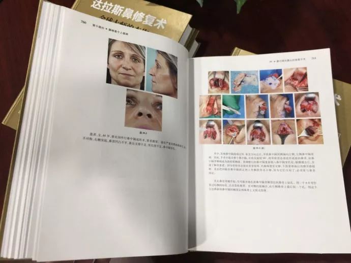 上海矫正牙齿,隐形矫正牙齿适合人群有哪些