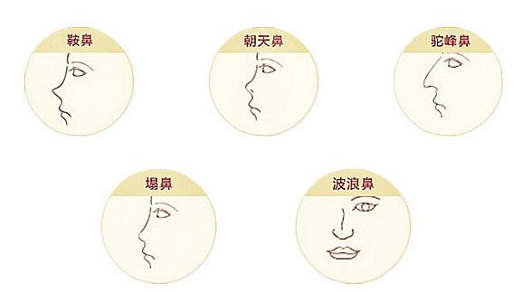 做开眼角手术有风险吗