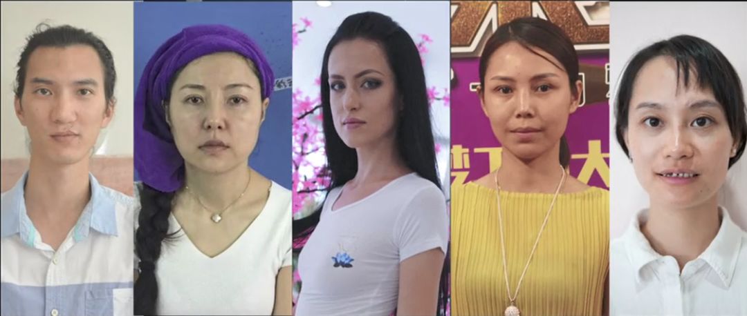 上海专业假体隆胸医院哪个好