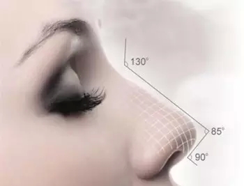 上海假体隆鼻有什么后遗症